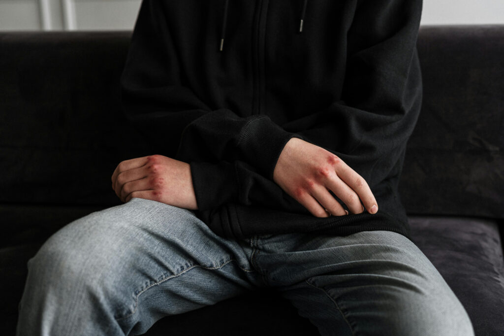 Niños conflictivos: Agresividad